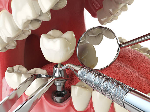Best Holiday Emergency Dentist in Livingston, TN
